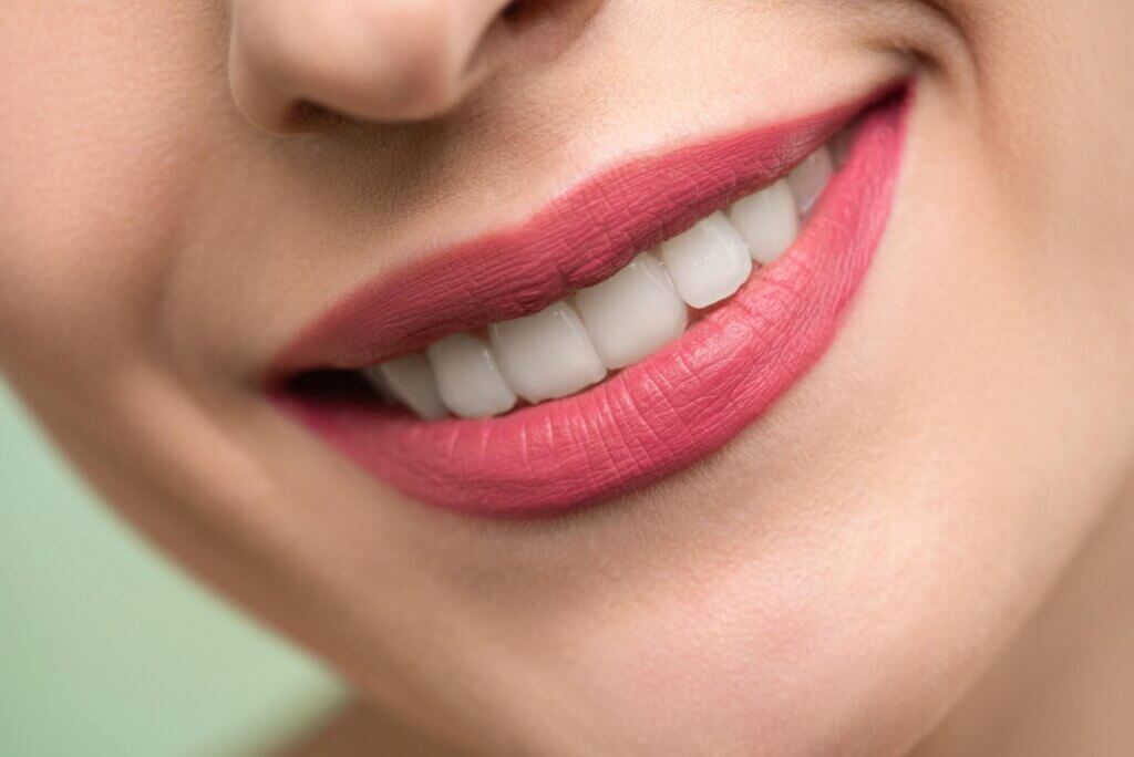 Best Teeth Whitening Kits