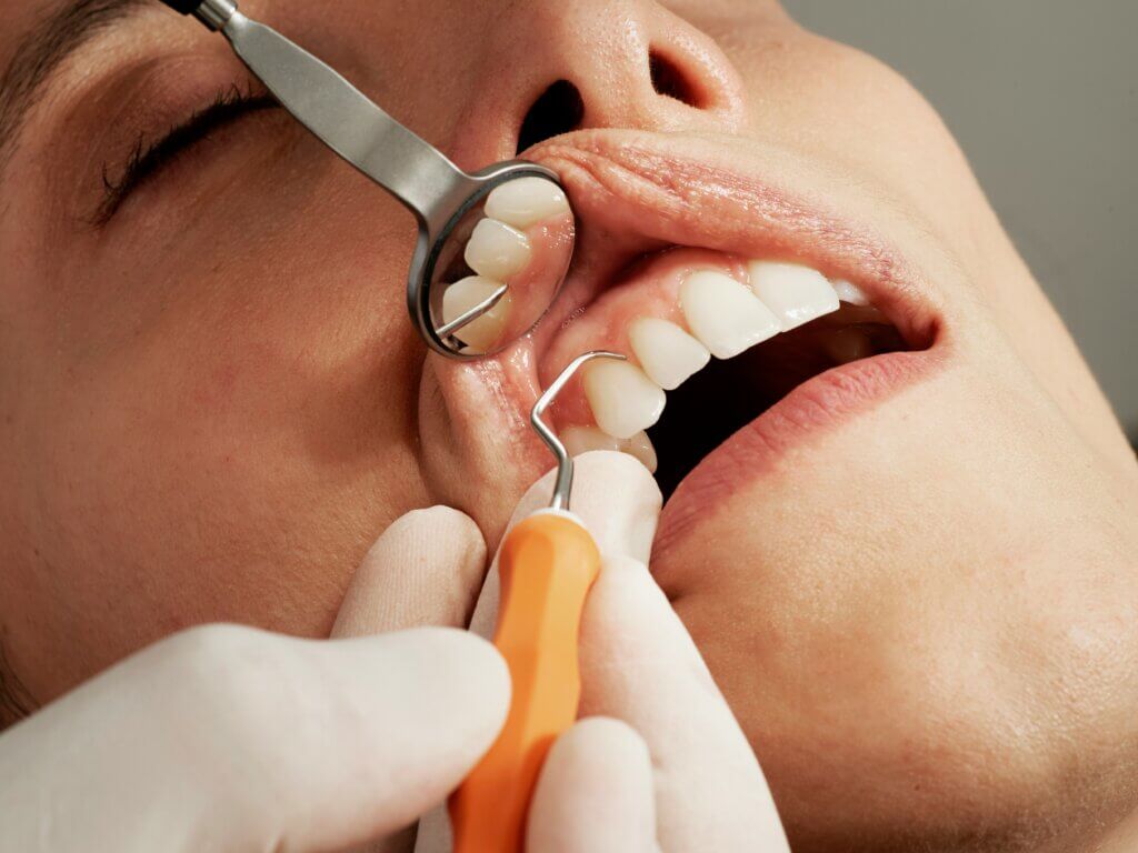 Best Floss Pickers