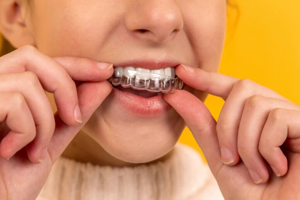 How To Clean A Retainer