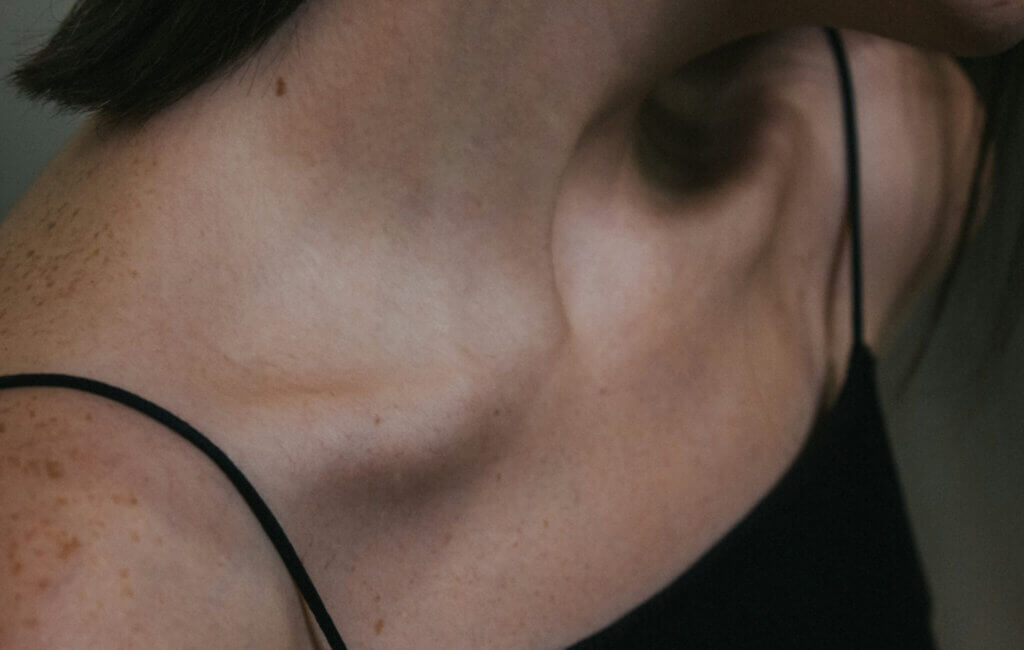 Best Silicone Scar Sheets